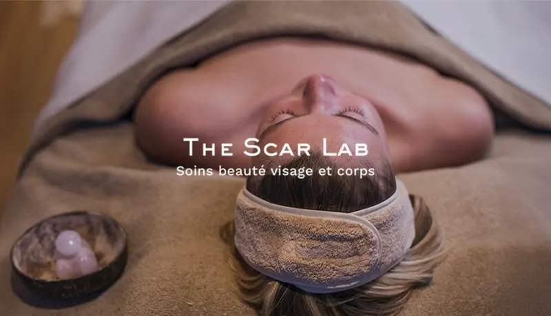 The Scar Lab