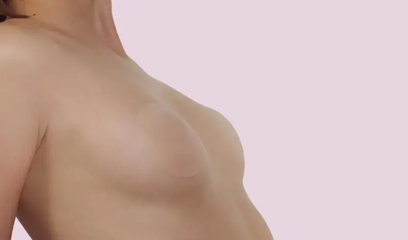 Lanoaï